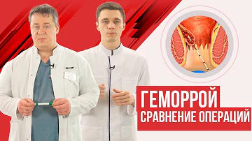 Геморрой, сравнение операций. Лазер, Хал-Рар, Геморроидэктомия, лигирование...