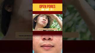 Open Pores क्यों होते हैं? | ओपन पोर्स का कारण | Skin Tips #shorts #ytshorts #youtubeshorts