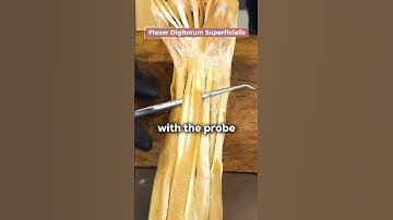 Look At This Real Human Forearm Muscle