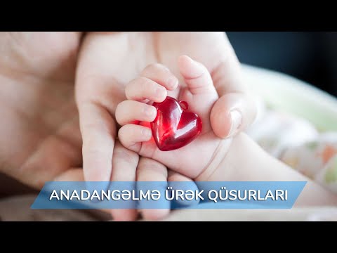 Video: Turner Sindromunu Necə Tanıyaq: 11 Adım (Şəkillərlə birlikdə)