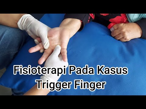 Mengatasi jari macet dengan mudah ||trigger finger