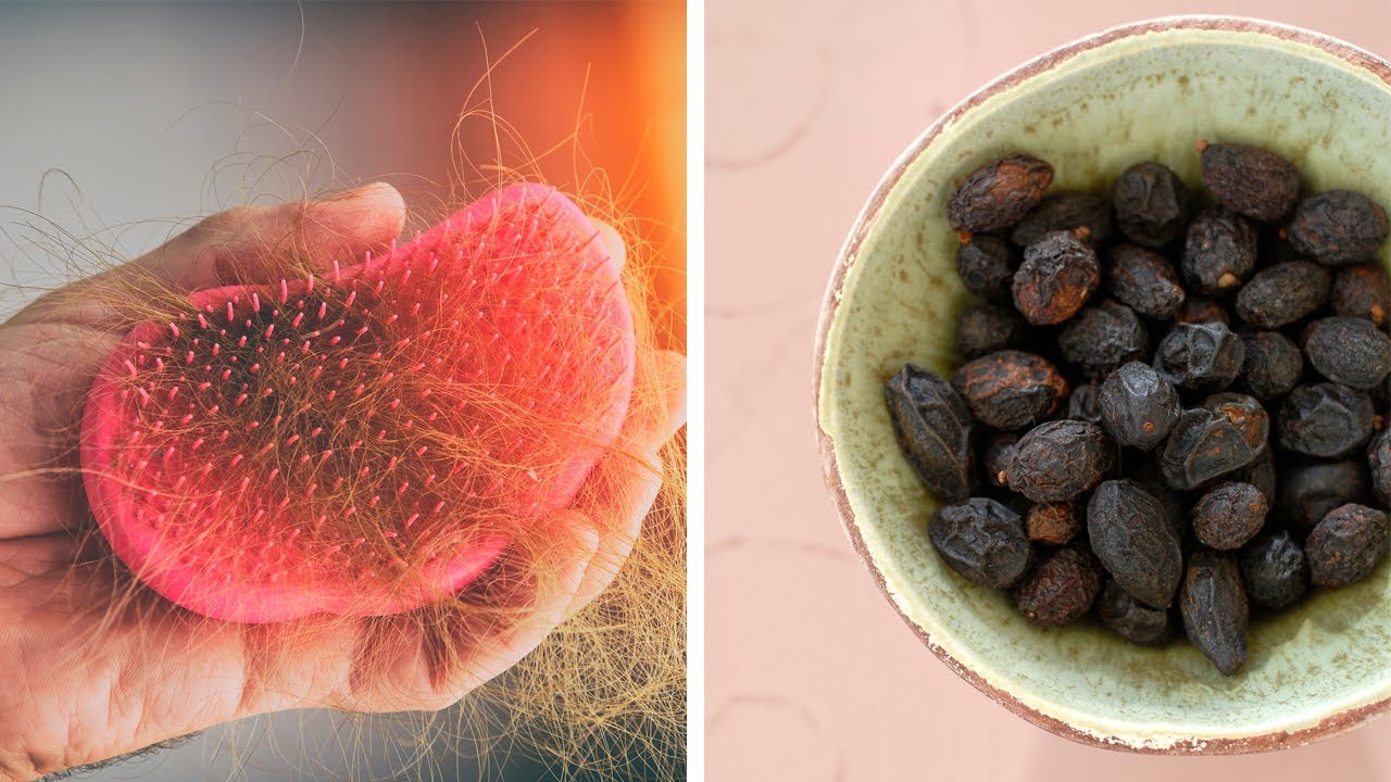 Does Saw Palmetto Really Work for Hair Loss? YouTube