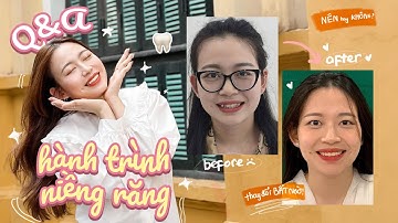 Q&A VỀ HÀNH TRÌNH NIỀNG RĂNG CỦA TUI | Thay đổi siêu bất ngờ 🥰🎉💯