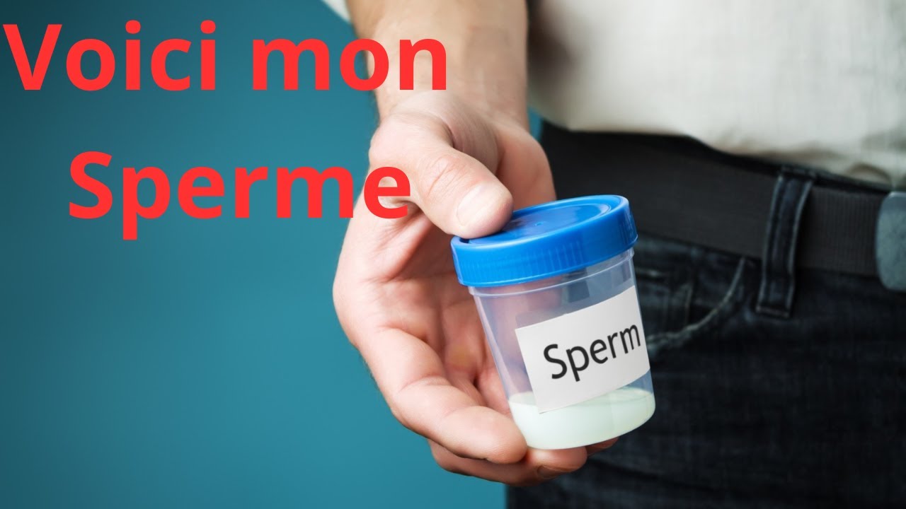 Conditions du spermogramme