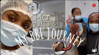 My First Bbl Journey Miami 2021  Mia Aesthetics  Drwright  6 Month Update 