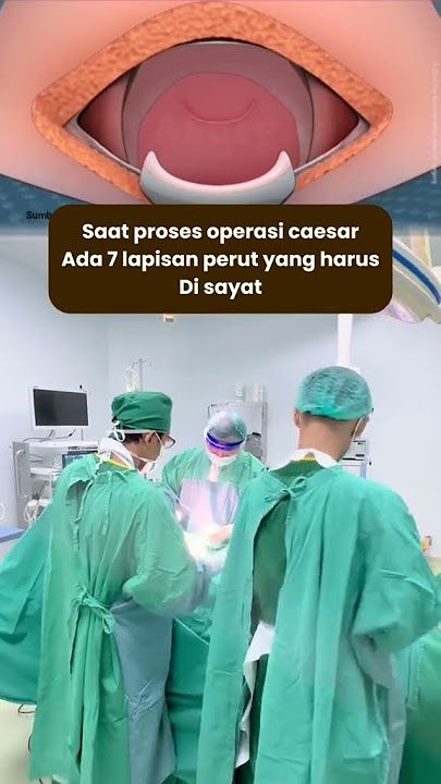 Saat Proses Operasi Caesar Ada 7 Lapisan - Medikacare