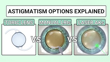 Cataract Surgery Astigmatism Treatment Options - MD Explains Toric Lenses and Other Options