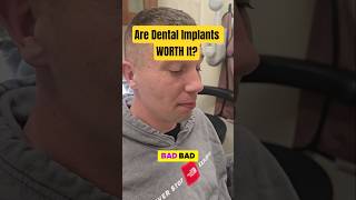 All on 4 Dental Implants Worth It | All ON 4 Dental Implant Review