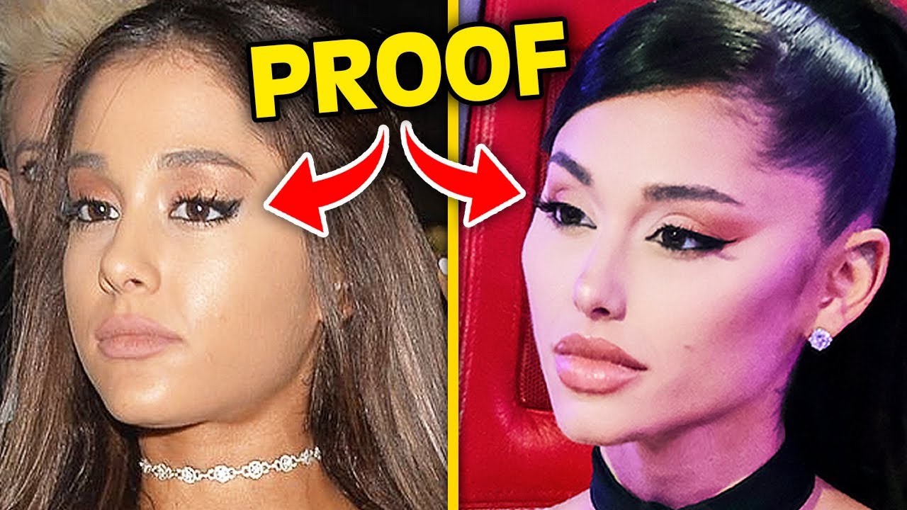 Top 10 Influencers Who DESTROYED Their Face With Plastic Surgery