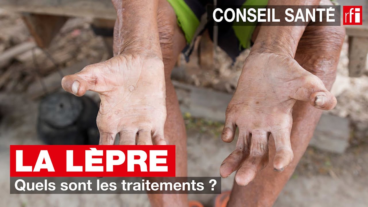 La lèpre : quels sont les traitements ?