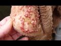 Intestinal Flukes In Stool