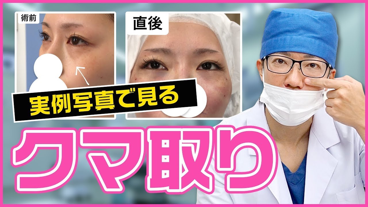 クマ取り】施術写真で驚異のクマ取りテクニックを解説！【湘南美容外科