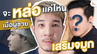 รีวิวจมูกผู้ชาย สไตล์หนุ่มโซเมโกะ เสริมจมูกแล้วหล่อขึ้นขนาดไหน คลิปเดียวจบค่ะ!