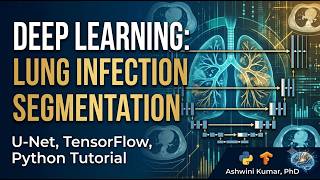 Deep Learning for Medical Image Segmentation