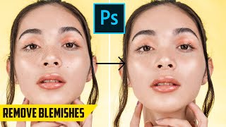 How to remove Blemishes, Acne and Face Scars - Quick Photoshop Tutorial screenshot 5