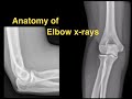 Anatomy of Elbow X-rays