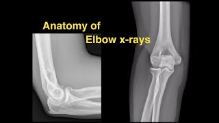 Anatomy of Elbow X-rays
