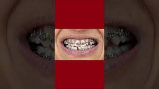 https://www.straightsmilesolutions.com/