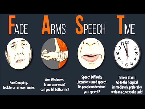 Signs You Had A Stroke And Might Not Know It Don't Ignore These Signs!