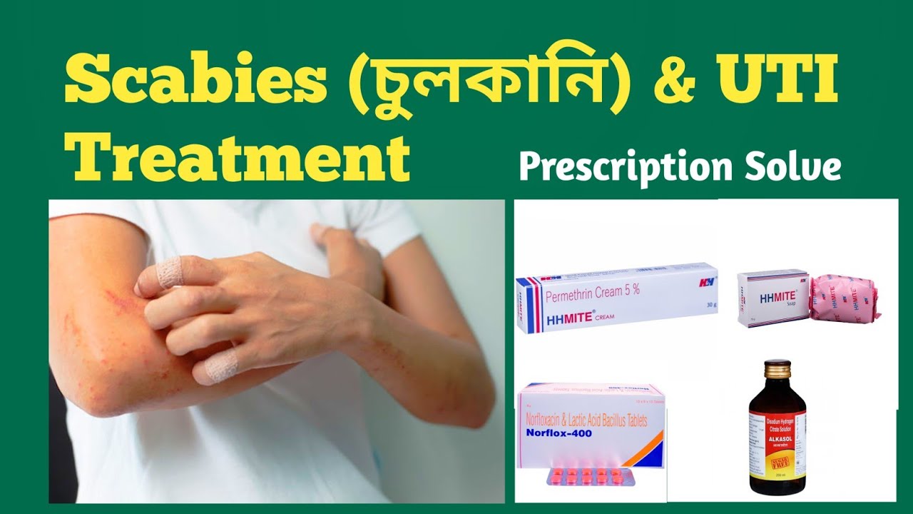 Scabies Primary Treatment & UTI - YouTube