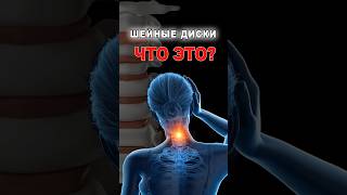ШЕЙНЫЕ ДИСКИ | Cervical Discs