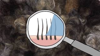 Famous Stop using shampoo #storyhopper Wealth