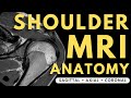 Shoulder mri anatomy  radiology anatomy part 1 prep  how to interpret a shoulder mri