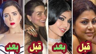 صور الفنانات العرب قبل وبعد عمليات التجميل .. فضايح | الجزء الأول