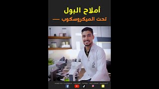 أملاح البول تحت الميكروسكوب       شكل أنواع #أملاح #البول #تحت #الميكروسكوب