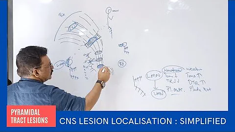 CNS Lesion Localisation at your Finger Tips by Dr Gireesh Kumar KP || Simplified Version