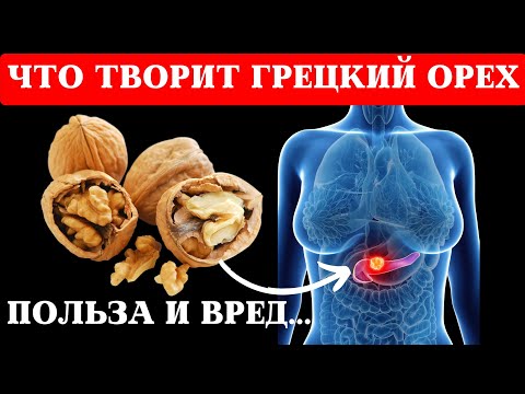 Вот ЧТО ТВОРИТ ГРЕЦКИЙ ОРЕХ! ВПЕЧАТЛЯЕТ! Польза грецкого ореха и вред..