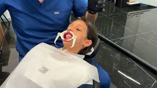 Diş Teli Taktırıyorum