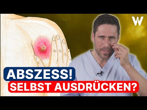 Video: Einen Zahnabszess identifizieren – wikiHow