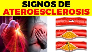 17 signs that you have ATHEROSCLEROSIS