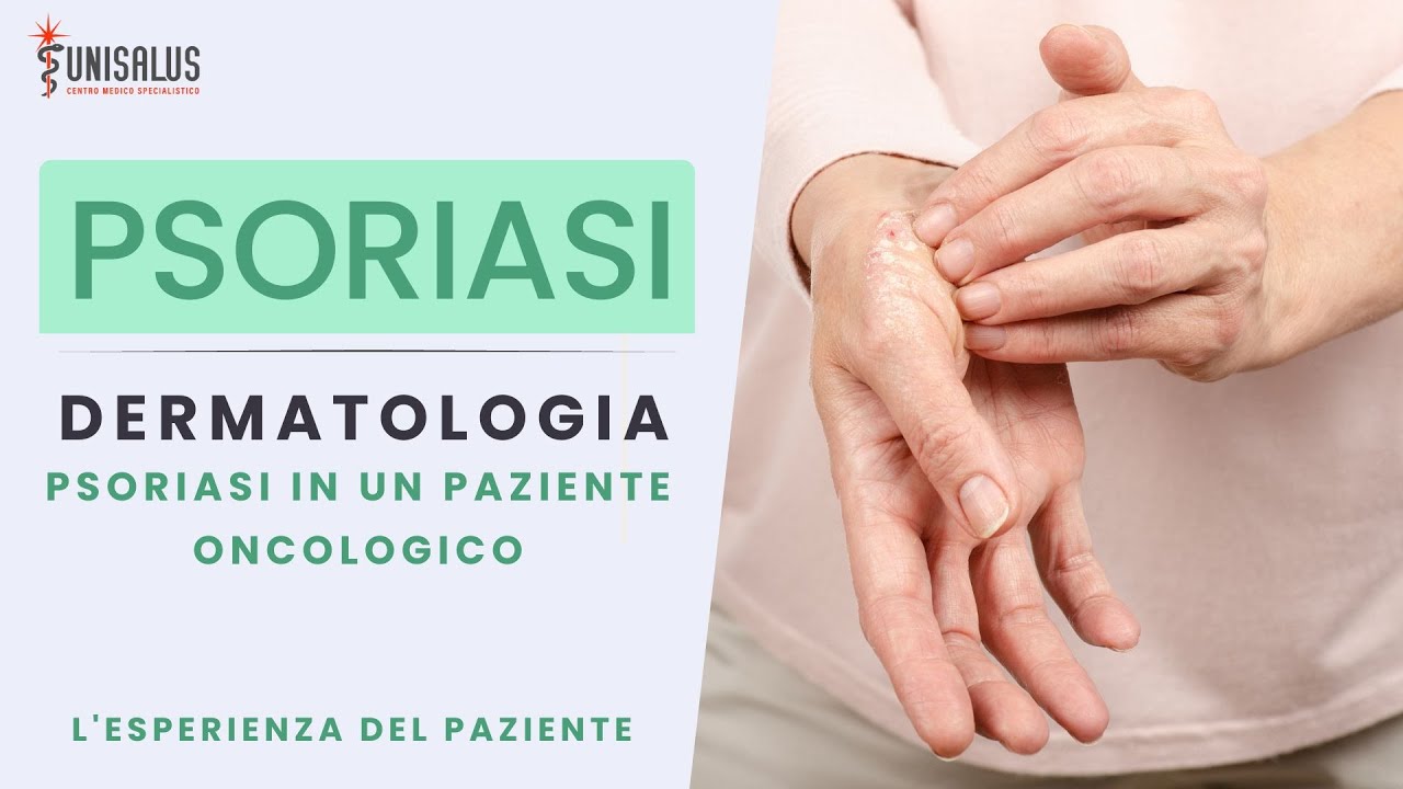 L'esperienza di un Paziente Oncologico affetto da Psoriasi - Dottoressa Marina Fantato