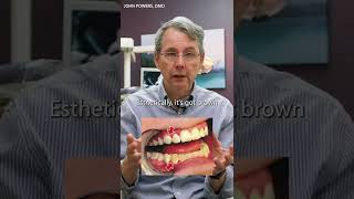 When do you have to get a dental crown? #shorts