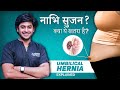 “Umbilical Hernia: एक छोटी सी समस्या जो बढ़ सकती है | Dr. Abhilash बताते हैं”