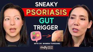 The Gut-Psoriasis Link What Your Dermatologist Isnt Telling You Dr. Mamina Turegano
