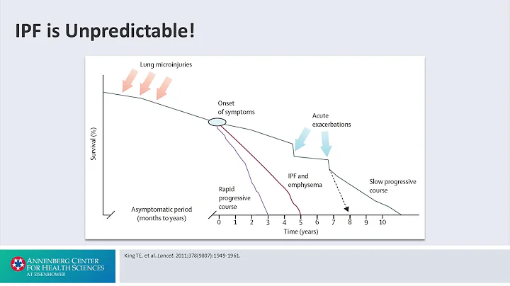 Treatment Principles: IPF is Unpredictable - Interstitial Lung Disease: Altering the Disease Course