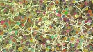 Immune System - Fighting Infection by Clonal Selection ... GT