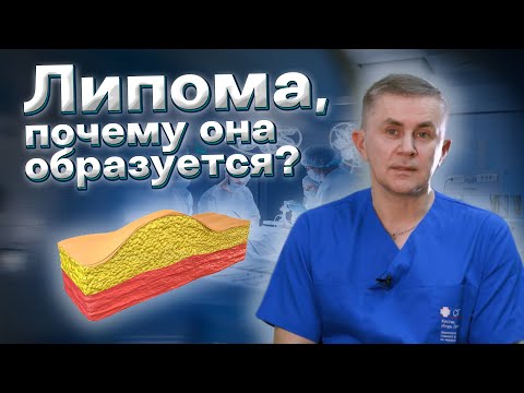 Что такое липома, почему она образуется?