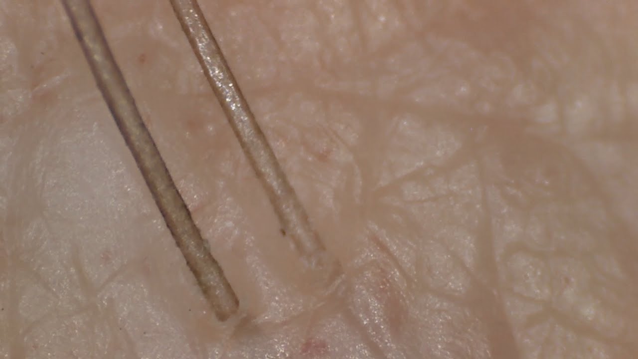 2. Hair Damage Under the Microscope - wide 8