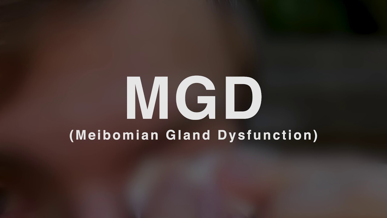 MGD Treatment Laster Eye Center Fort Smith, AR YouTube