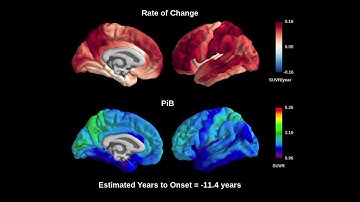 Voxel-wise change for beta-amyloid deposition by PiB PET in mutation carriers