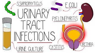 UTI Made Easy - Urinary Tract Infections Explained Clearly by Rhesus Medicine 18,282 views 9 months ago 8 minutes, 25 seconds