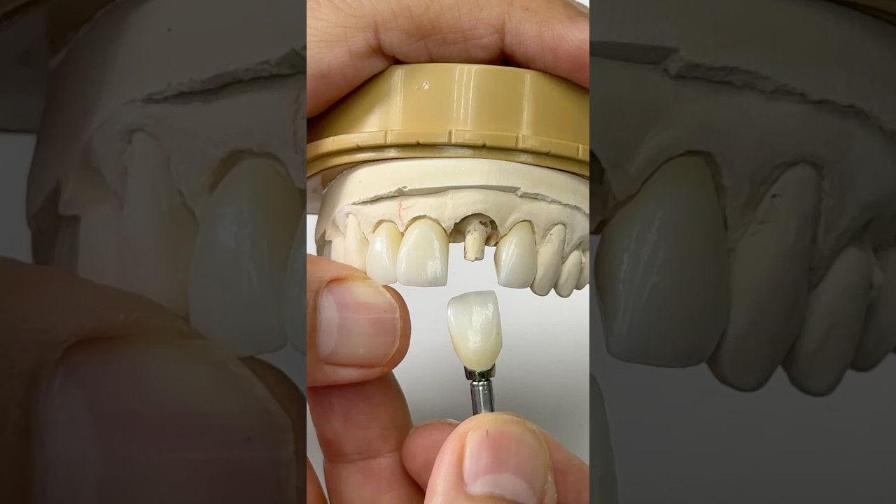 Фирменные коронки для доктора Эрика Сванса в Аризоне