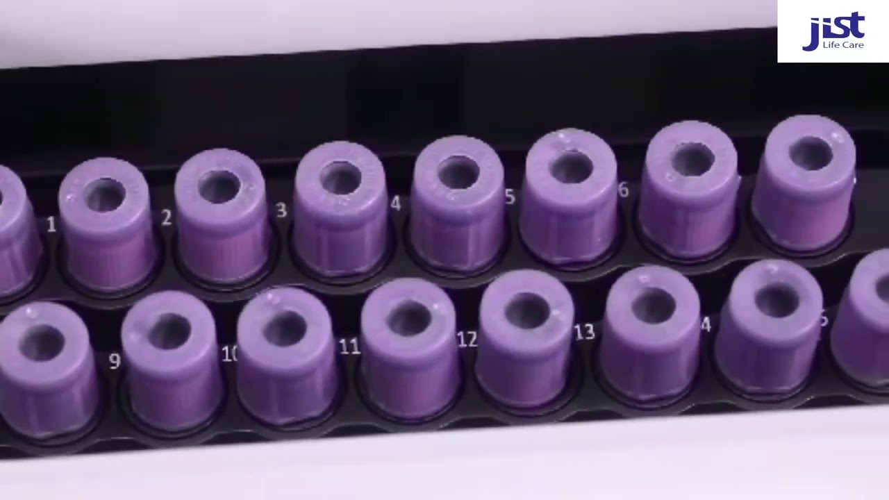 YHLO-- Vision pro automatic ESR analyser.