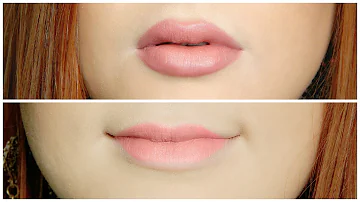 Quais as técnicas para preenchimento labial?