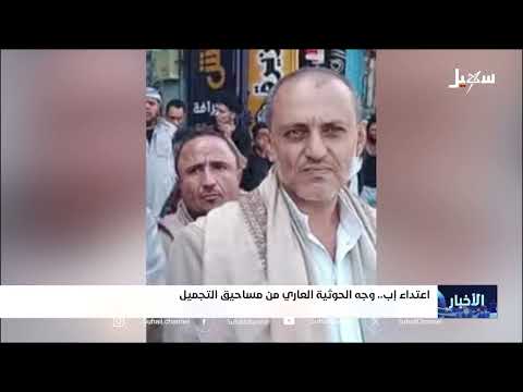 اعتداء حوثي على طبيبة من تعز يثير غضباً واسعاً