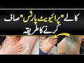Black Underarms Ko White Kaise Kare - How To Remove Pigmentation - Kali Bagal Ko Gora Kaise Kare
